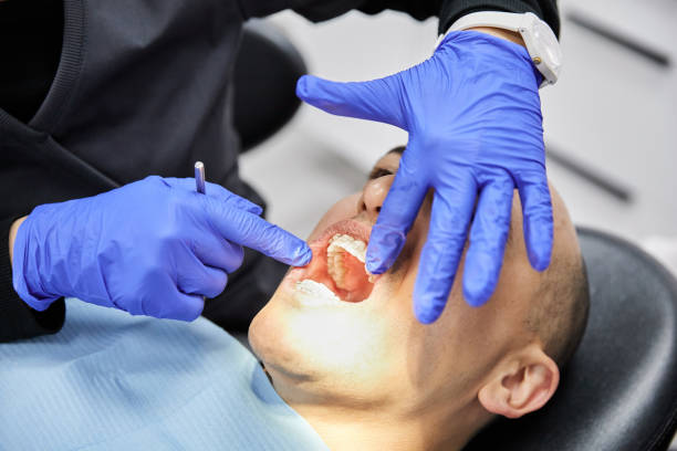 Best Emergency Dental Care for Broken or Chipped Teeth in Indian Wells, CA